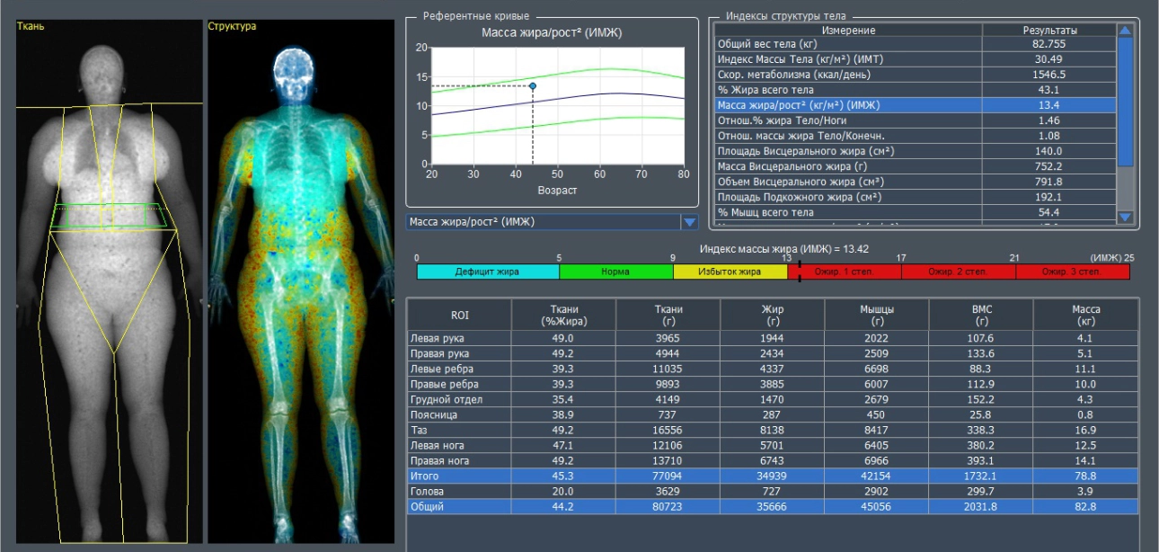 Mindray Ultrasound : Multiparametric Ultrasound in Fatty Liver Disease